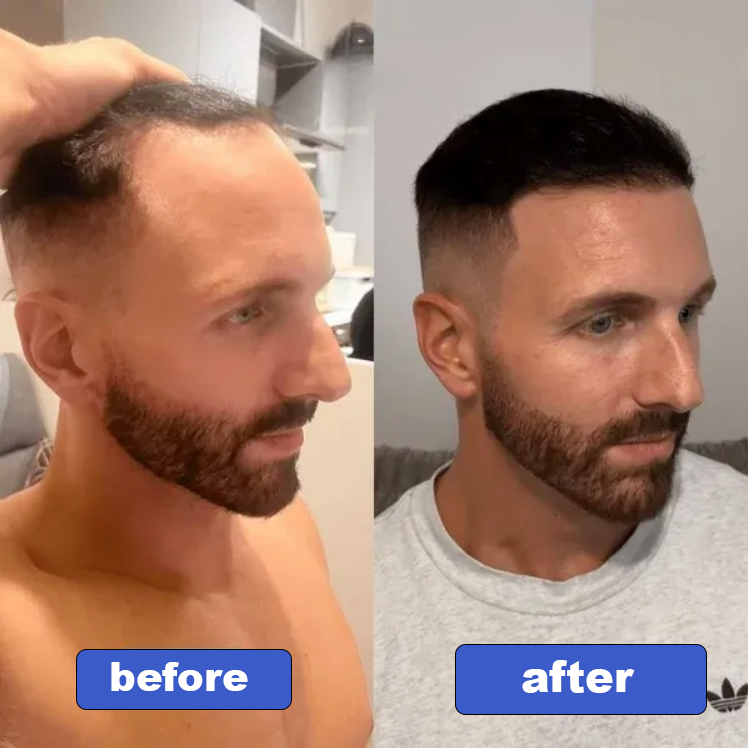 Hair Revive Oil