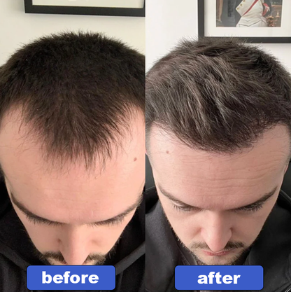 Hair Revive Oil